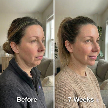 💖Trusted-by-over-50-000-women💖Collagen Face Sculpt Wrap